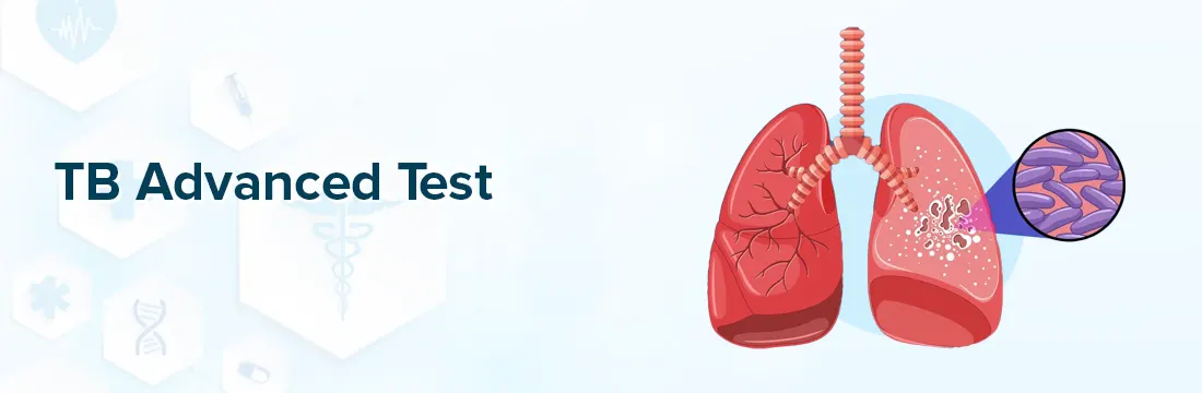 Understand Why You Need Advanced Testing Methods in TB: Get Better Diagnosis Today